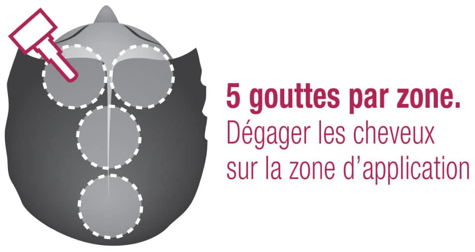 Utiliser 5 gouttes par zone avec le concentré Hair Summum